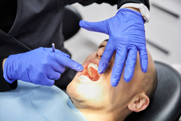 Best Root Canal Emergency Dentist  in Binghamton, NY
