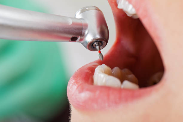 Best Cracked Tooth Emergency Dentist  in Binghamton, NY